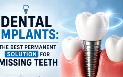 Dental Implants: The Best Permanent Solution for Missing Teeth