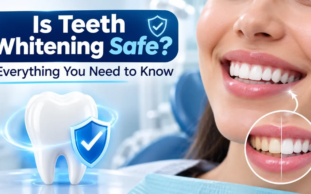 Is Teeth Whitening Safe? Everything You Need to Know