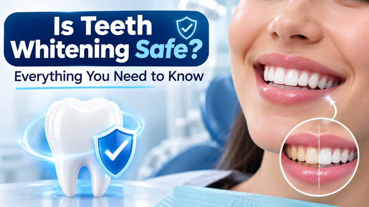 Is Teeth Whitening Safe? Everything You Need to Know